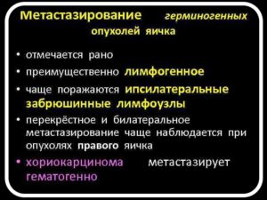 герминогенные опухоли яичка